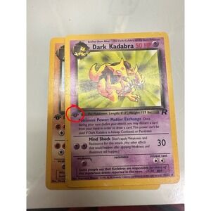 Dark Kadabra 1st Edition 39/82 Grey Stamp Error Misprint Pokemon Card